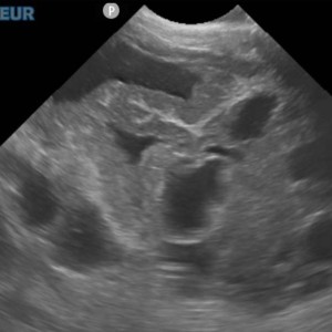 Échographie de la zone tumorale réalisée par Vet&View